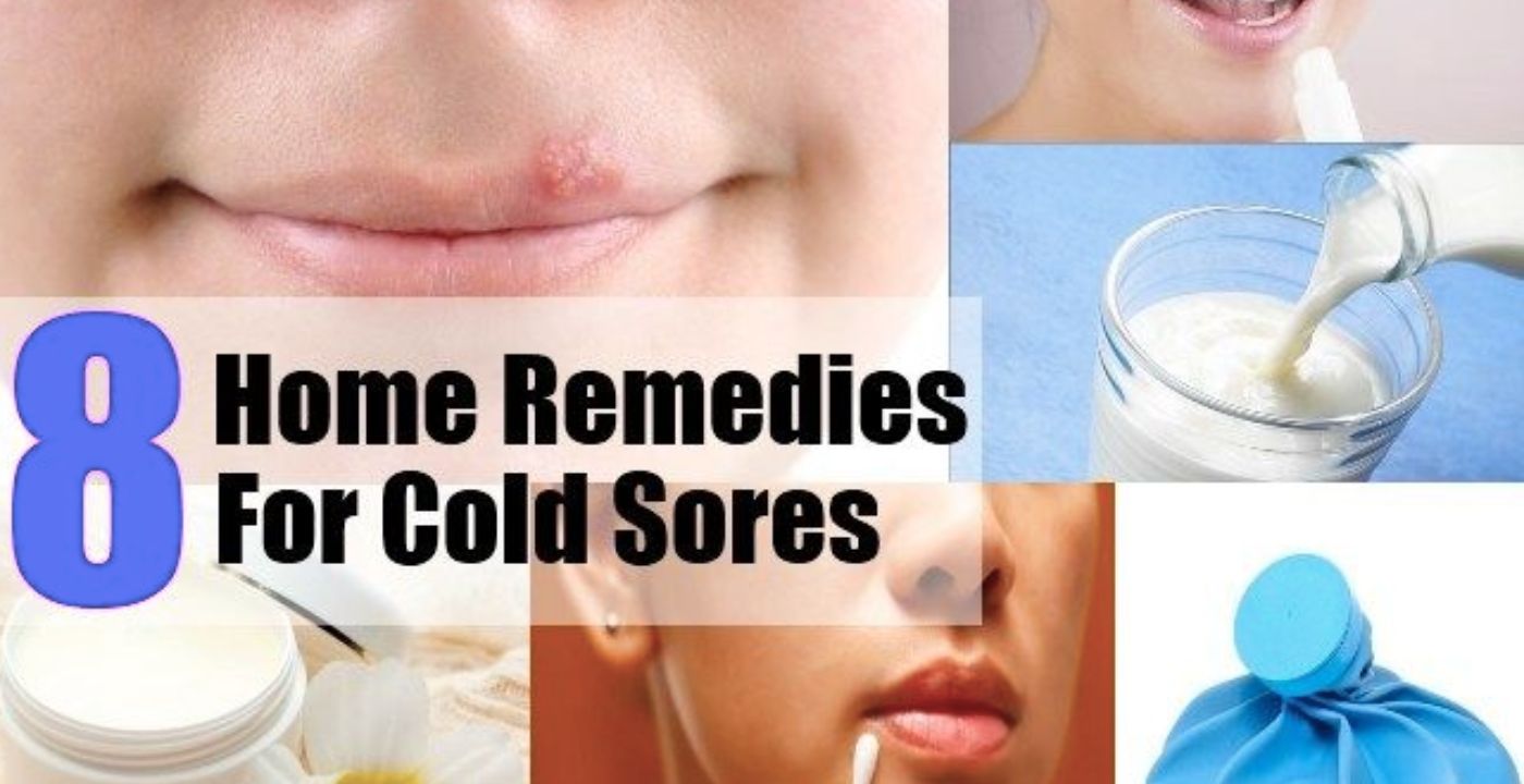Cold Blisters: Causes, Prevention, and Treatment
